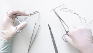 Chỉ phẫu thuật không tiêu và những điều nhiều người còn thắc mắc