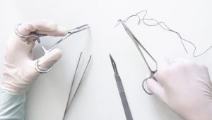 Khi nào thì nên sử dụng chỉ tự tiêu?